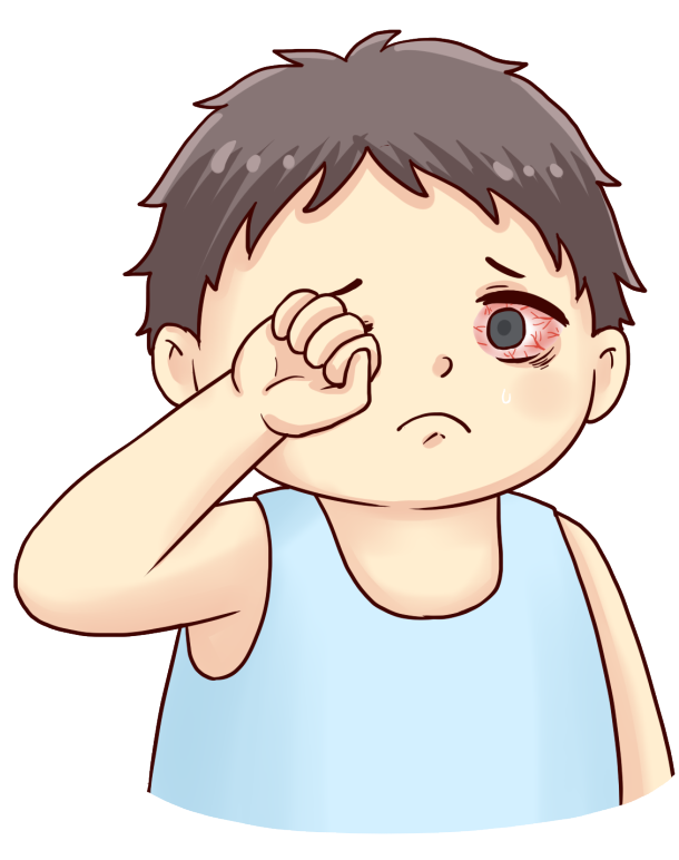 【科普】红眼病来了，如何防治看这里~